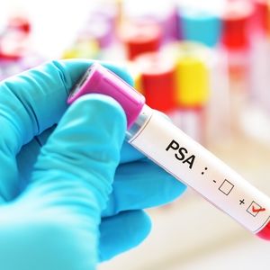 Understanding PSA Levels: A Comprehensive Guide to Normal and Elevated Ranges
