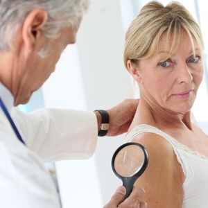 Understanding Lupus of the Skin: Causes, Symptoms, and Management